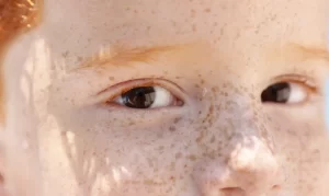 Reflexo branco nos olhos: entenda condição que assusta pais